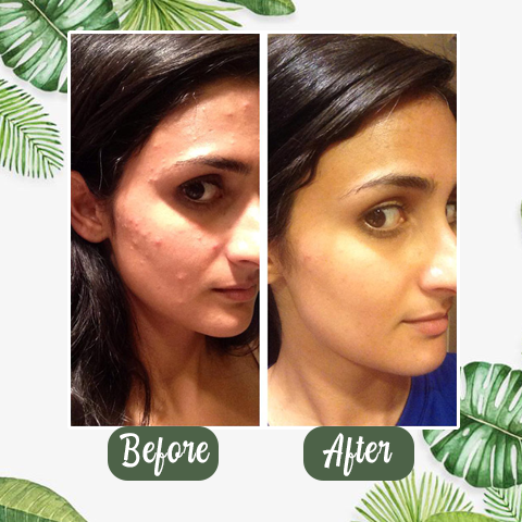 Diystar™Natural Green Tea Clay Mask