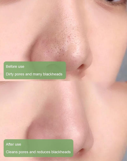 Diystar™Natural Green Tea Clay Mask