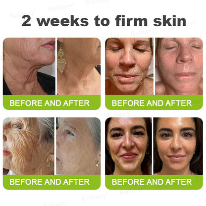 🌟👨‍⚕️Made and shipped from Australia 💫Rolimey® Botox & Vita-A Retinol Shot Wrinkle-Lift Tightening cream - Last Day Promotion 70% OFF