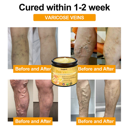 Cougex® Bee Venom Advanced Joint and Bone Healing Cream