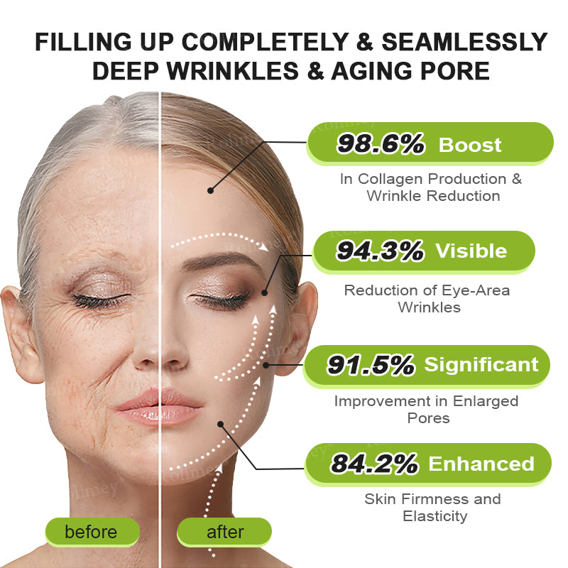 🌟👨‍⚕️Made and shipped from Australia 💫Rolimey® Botox & Vita-A Retinol Shot Wrinkle-Lift Tightening cream - Last Day Promotion 70% OFF