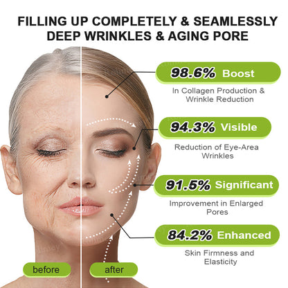 🌟👨‍⚕️Made and shipped from Australia 💫Rolimey® Botox & Vita-A Retinol Shot Wrinkle-Lift Tightening cream - Last Day Promotion 70% OFF