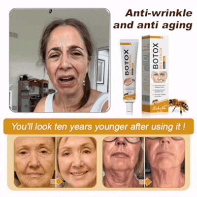 (💎💎Made and Shipped from UK✅) Rekulo™ Botox Bee Venom Wrinkle Removal Cream- LAST DAY 70% OFF