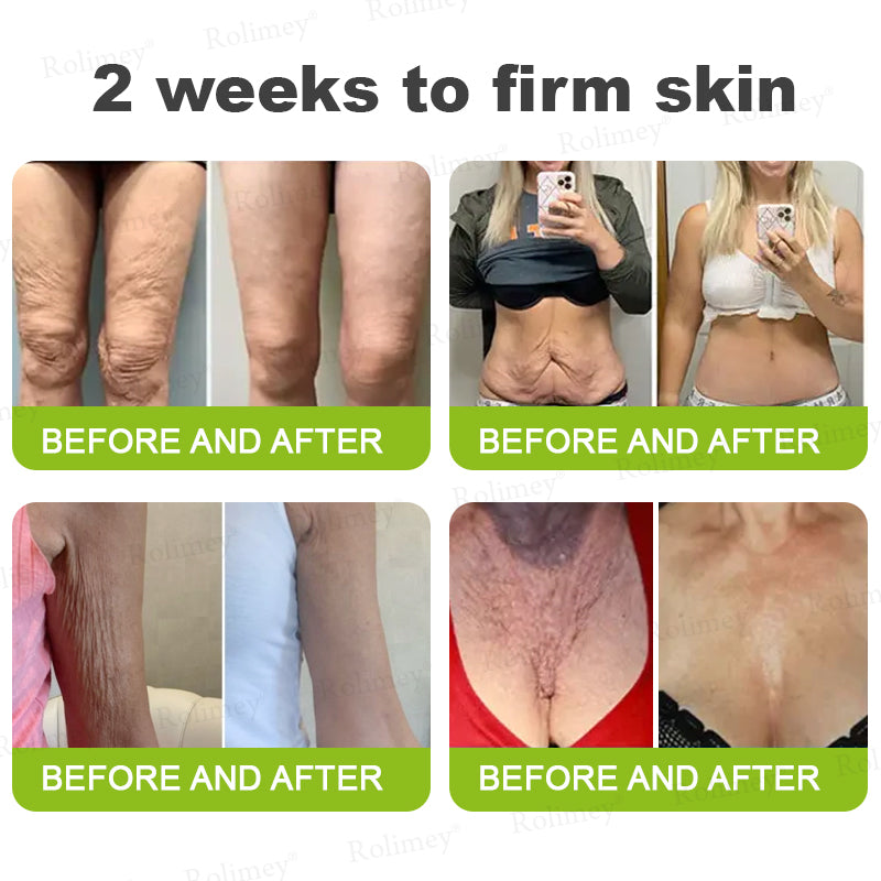 🌟👨‍⚕️Made and shipped from Australia 💫Rolimey® Botox & Vita-A Retinol Shot Wrinkle-Lift Tightening cream - Last Day Promotion 70% OFF