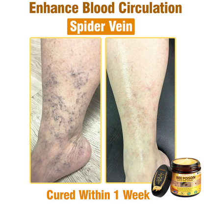 LOVILDS™ Bee Poison All-in-One Cream US Dermatologist Approved.