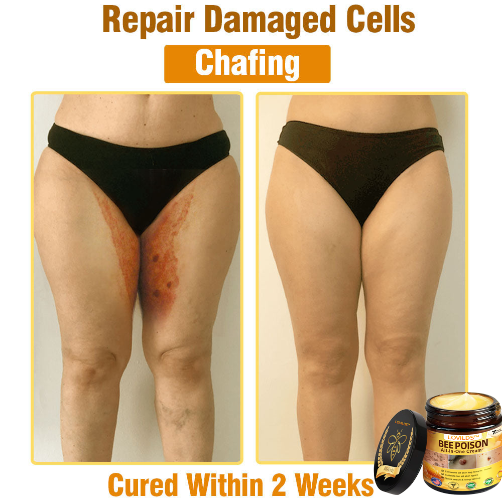 LOVILDS™ Bee Poison All-in-One Cream US Dermatologist Approved.