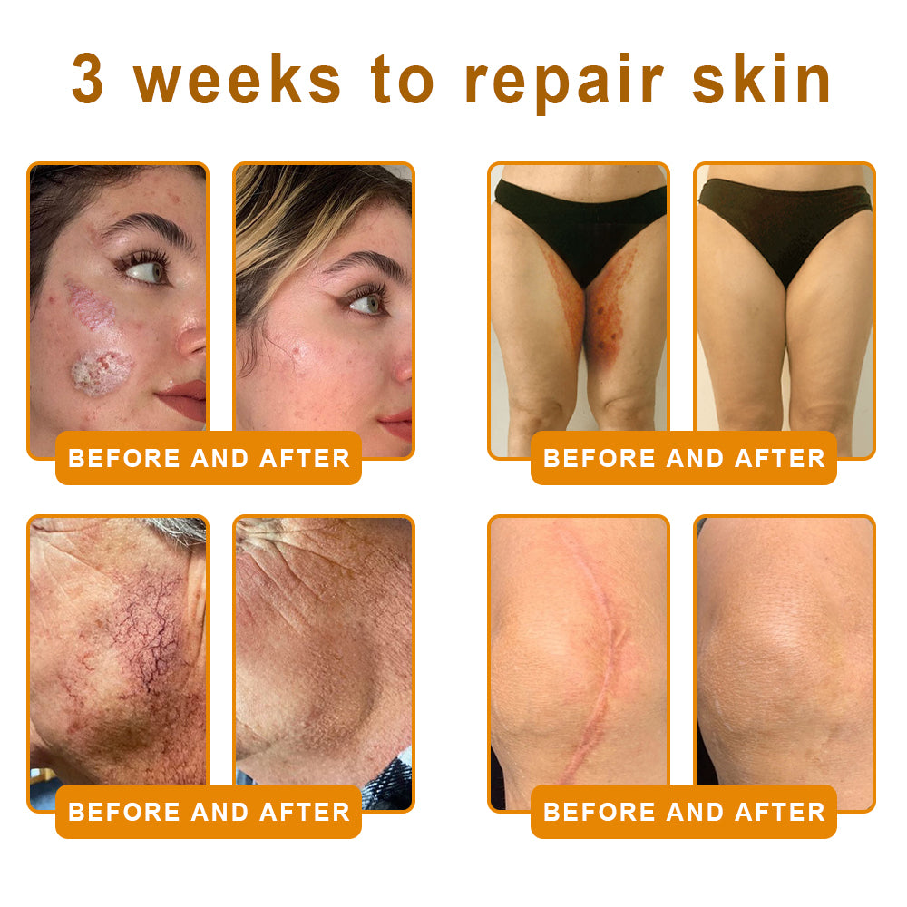 ✨FDA Approved:LOVILDS™  Bee Venom Skin Restoration Cream — 🔥Limited Time 70% OFF🔥