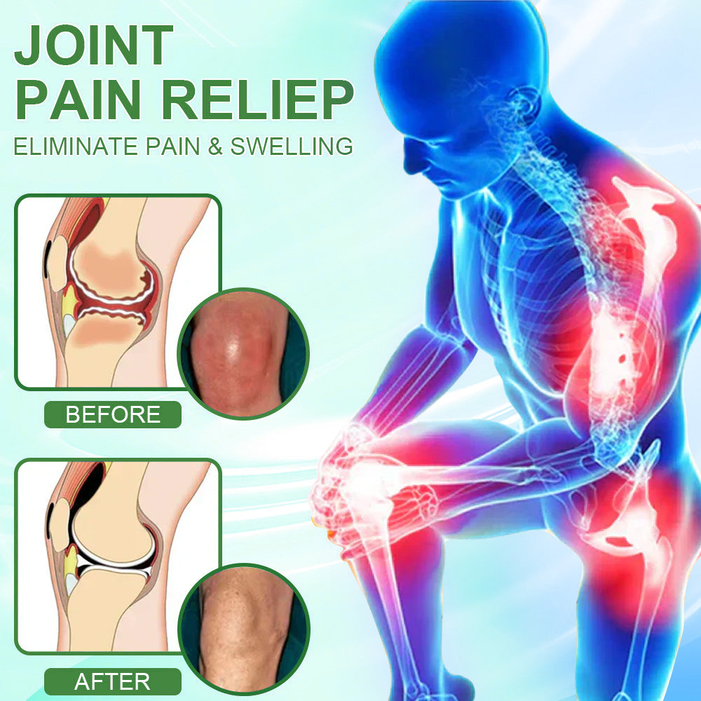🎁𝐎𝐟𝐟𝐢𝐜𝐢𝐚𝐥 𝐒𝐭𝐨𝐫𝐞: DivGlow® Chillflex Mint Pain Relief Cream  (Treatment for arthritis, neuropathyy, rheumatic diseases, muscle spasms, twitches and sports injuries)