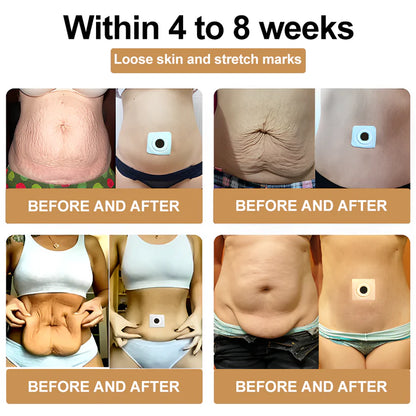 Perfect Detox Slimming Patch（Limited Time Discount 🔥 Last Day）