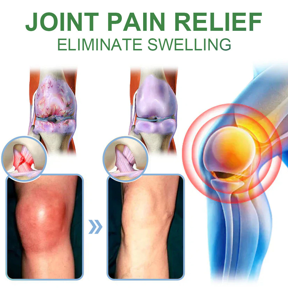 🎁𝐎𝐟𝐟𝐢𝐜𝐢𝐚𝐥 𝐒𝐭𝐨𝐫𝐞: DivGlow® Chillflex Mint Pain Relief Cream  (Treatment for arthritis, neuropathyy, rheumatic diseases, muscle spasms, twitches and sports injuries)