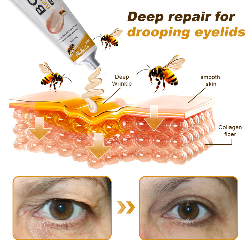 (💎💎Made and Shipped from UK✅) Rekulo™ Botox Bee Venom Wrinkle Removal Cream- LAST DAY 70% OFF