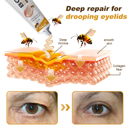 (💎💎Made and Shipped from UK✅) Rekulo™ Botox Bee Venom Wrinkle Removal Cream- LAST DAY 70% OFF