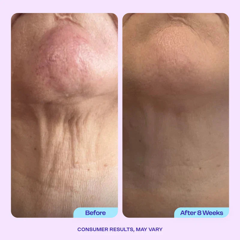 Neck Fixing Advanced Firming Neck Cream – Visibly Lifts & Tightens