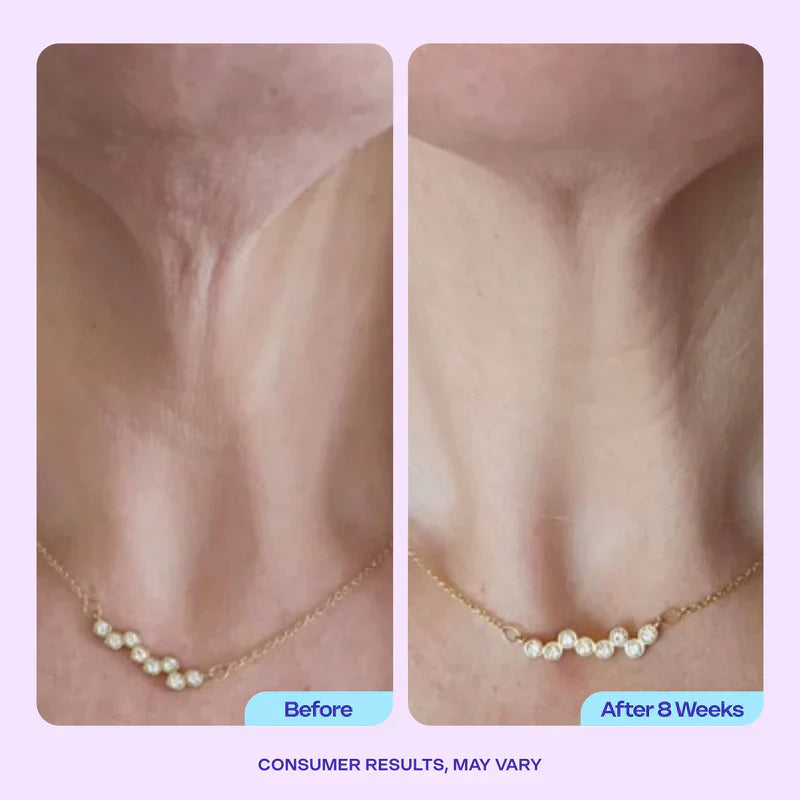 Neck Fixing Advanced Firming Neck Cream – Visibly Lifts & Tightens