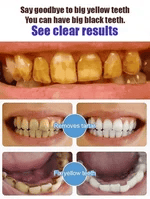 ❤️Teeth Whitening Powder | Whitening and Stain Removal