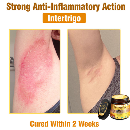 LOVILDS™ Bee Poison All-in-One Cream US Dermatologist Approved.