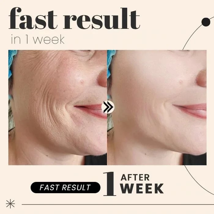 💖 New Year Sale- 40% OFF🌹 Collagen tight hydration and moisturizing mask