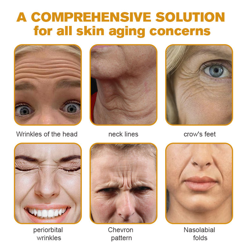 (💎💎Made and Shipped from UK✅) Rekulo™ Botox Bee Venom Wrinkle Removal Cream- LAST DAY 70% OFF