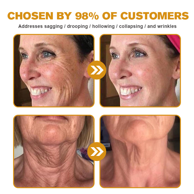 (💎💎Made and Shipped from UK✅) Rekulo™ Botox Bee Venom Wrinkle Removal Cream- LAST DAY 70% OFF