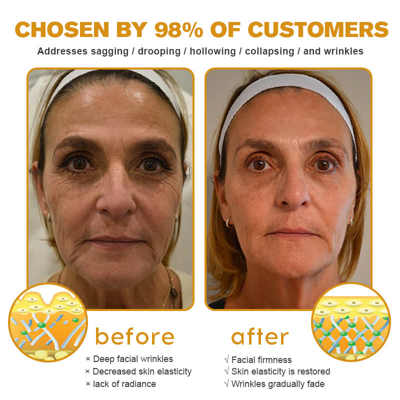 (💎💎Made and Shipped from UK✅) Rekulo™ Botox Bee Venom Wrinkle Removal Cream- LAST DAY 70% OFF