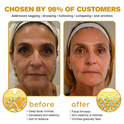 (💎💎Made and Shipped from UK✅) Rekulo™ Botox Bee Venom Wrinkle Removal Cream- LAST DAY 70% OFF