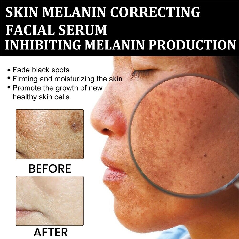 Fast Dark Spot Remover-AQA Melanin Correcting Facial Serum